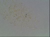 Echiniscus knowltoni image