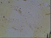 Echiniscus knowltoni image