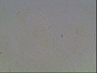 Echiniscus knowltoni image
