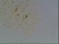 Echiniscus knowltoni image