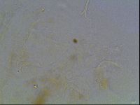 Echiniscus knowltoni image