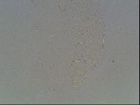 Echiniscus knowltoni image