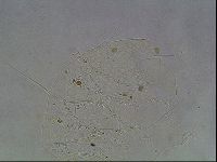Echiniscus knowltoni image