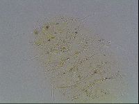 Echiniscus knowltoni image