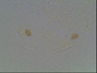 Echiniscus knowltoni image