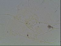 Echiniscus knowltoni image