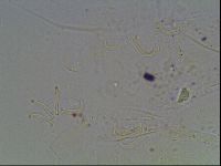 Echiniscus knowltoni image