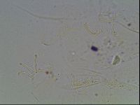 Echiniscus knowltoni image