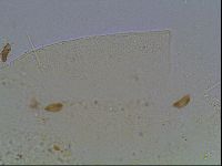 Echiniscus knowltoni image