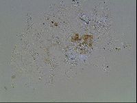 Echiniscus knowltoni image