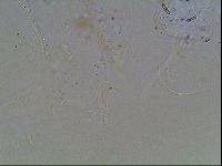 Echiniscus knowltoni image