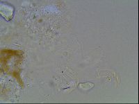 Echiniscus knowltoni image
