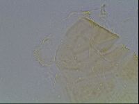 Echiniscus kofordi image