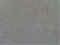 Testechiniscus laterculus image