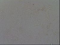 Testechiniscus laterculus image