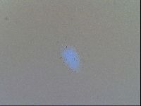 Testechiniscus laterculus image