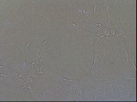 Testechiniscus laterculus image