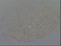 Testechiniscus laterculus image