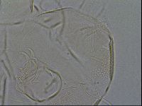 Testechiniscus laterculus image