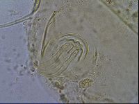 Testechiniscus laterculus image