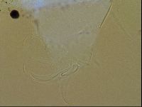 Testechiniscus laterculus image