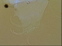 Testechiniscus laterculus image
