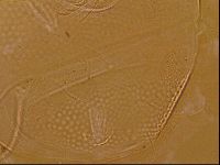 Testechiniscus laterculus image