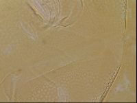 Testechiniscus laterculus image