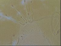 Testechiniscus laterculus image