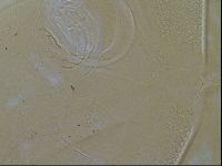Testechiniscus laterculus image