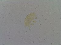 Testechiniscus laterculus image