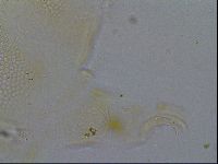 Testechiniscus laterculus image