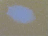 Testechiniscus laterculus image