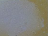 Testechiniscus laterculus image