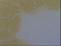Testechiniscus laterculus image