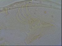 Testechiniscus laterculus image