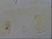 Testechiniscus laterculus image