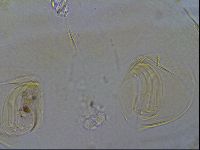 Testechiniscus laterculus image
