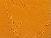 Testechiniscus laterculus image