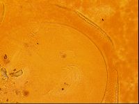 Testechiniscus laterculus image