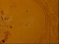 Testechiniscus laterculus image
