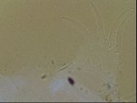 Testechiniscus laterculus image