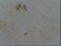 Testechiniscus laterculus image