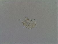 Testechiniscus laterculus image