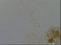 Testechiniscus laterculus image