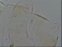 Testechiniscus laterculus image