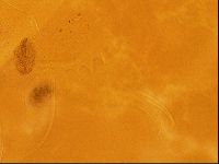Testechiniscus laterculus image