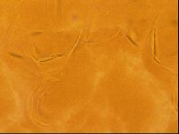 Testechiniscus laterculus image