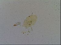 Testechiniscus laterculus image