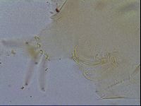Testechiniscus laterculus image